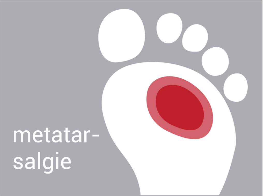 metatarsalgie